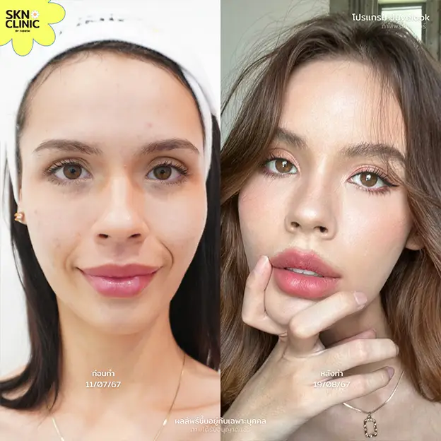 รีวิว Juvelook ผิวฉ่ำวาว รูขุมขนกระชับ
