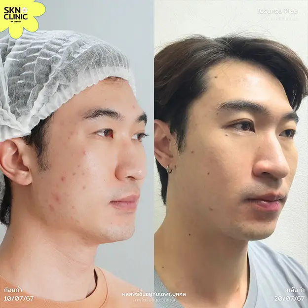 รีวิว - 38