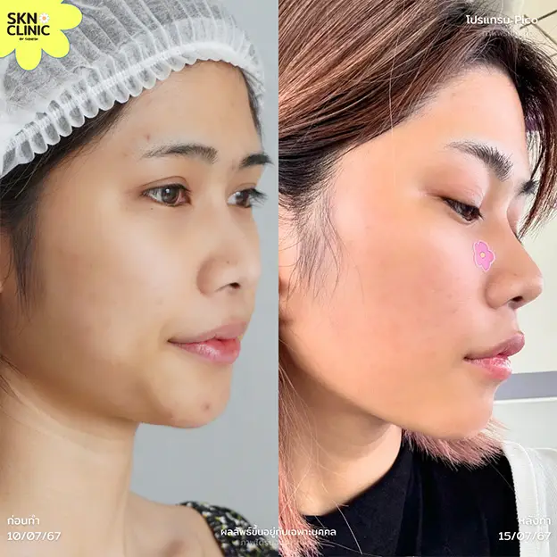 รีวิว - 38